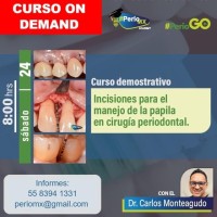 Incisiones para el manejo de la papila en cirugía periodontal 